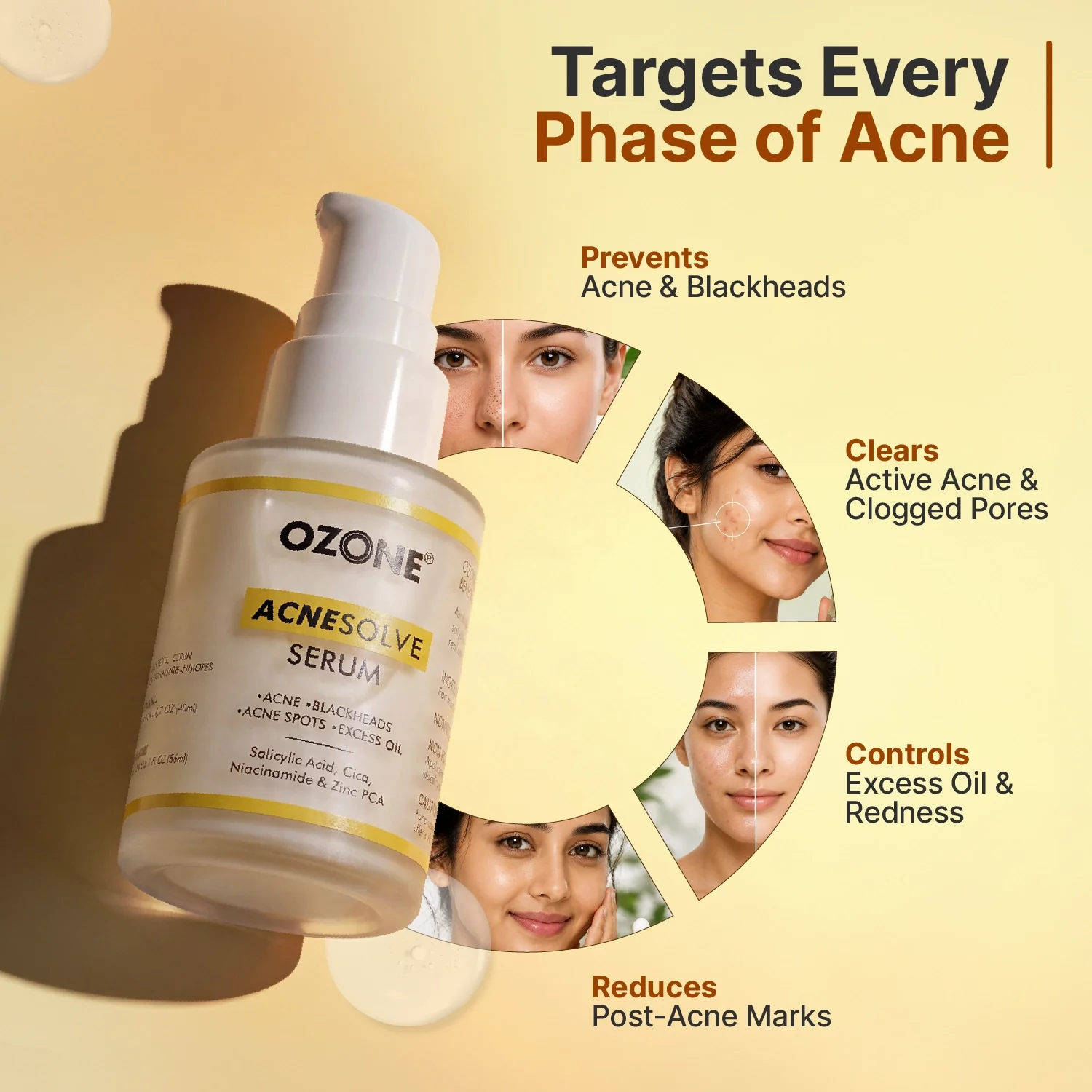 AcneSolve Serum - Image 4