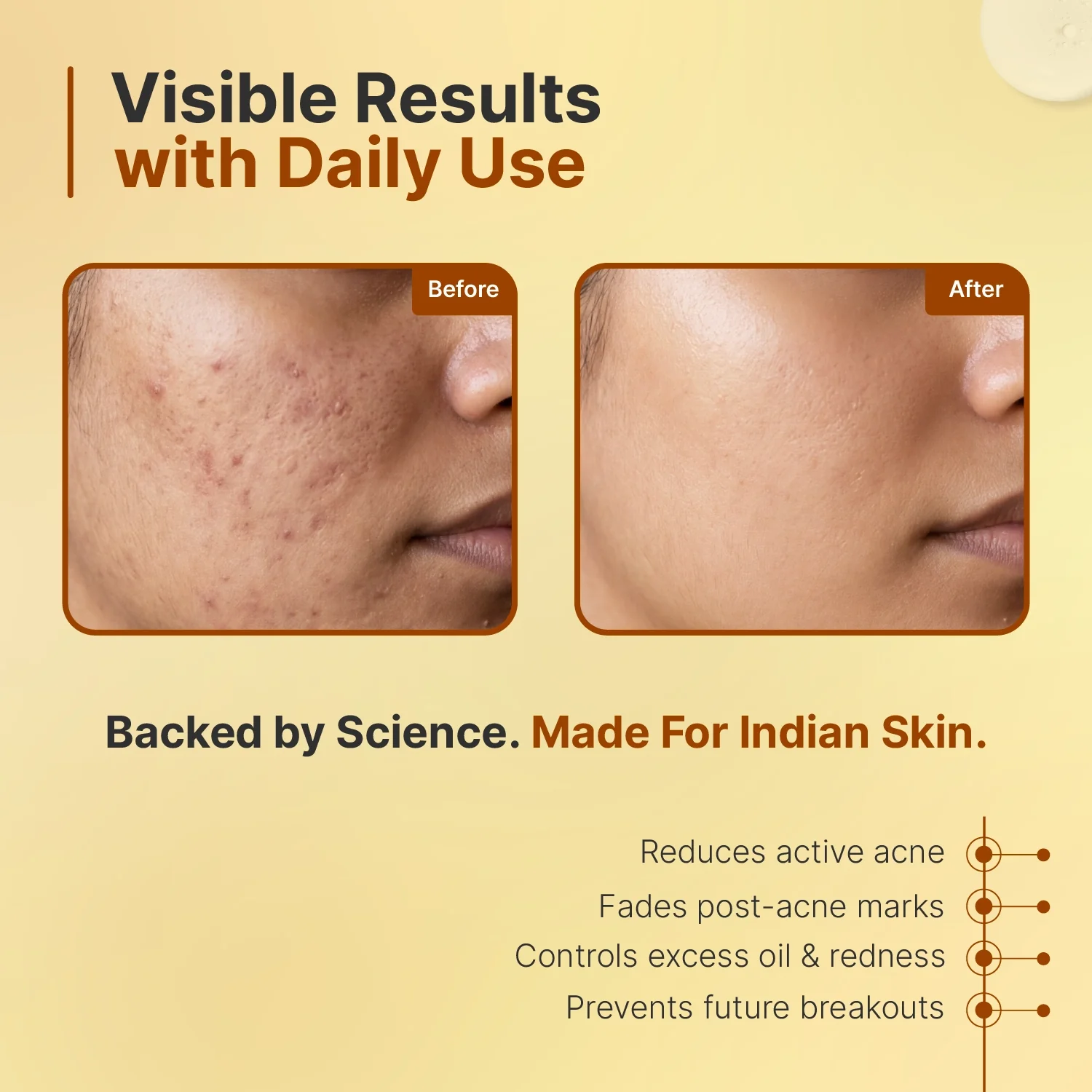 AcneSolve Serum - Image 8