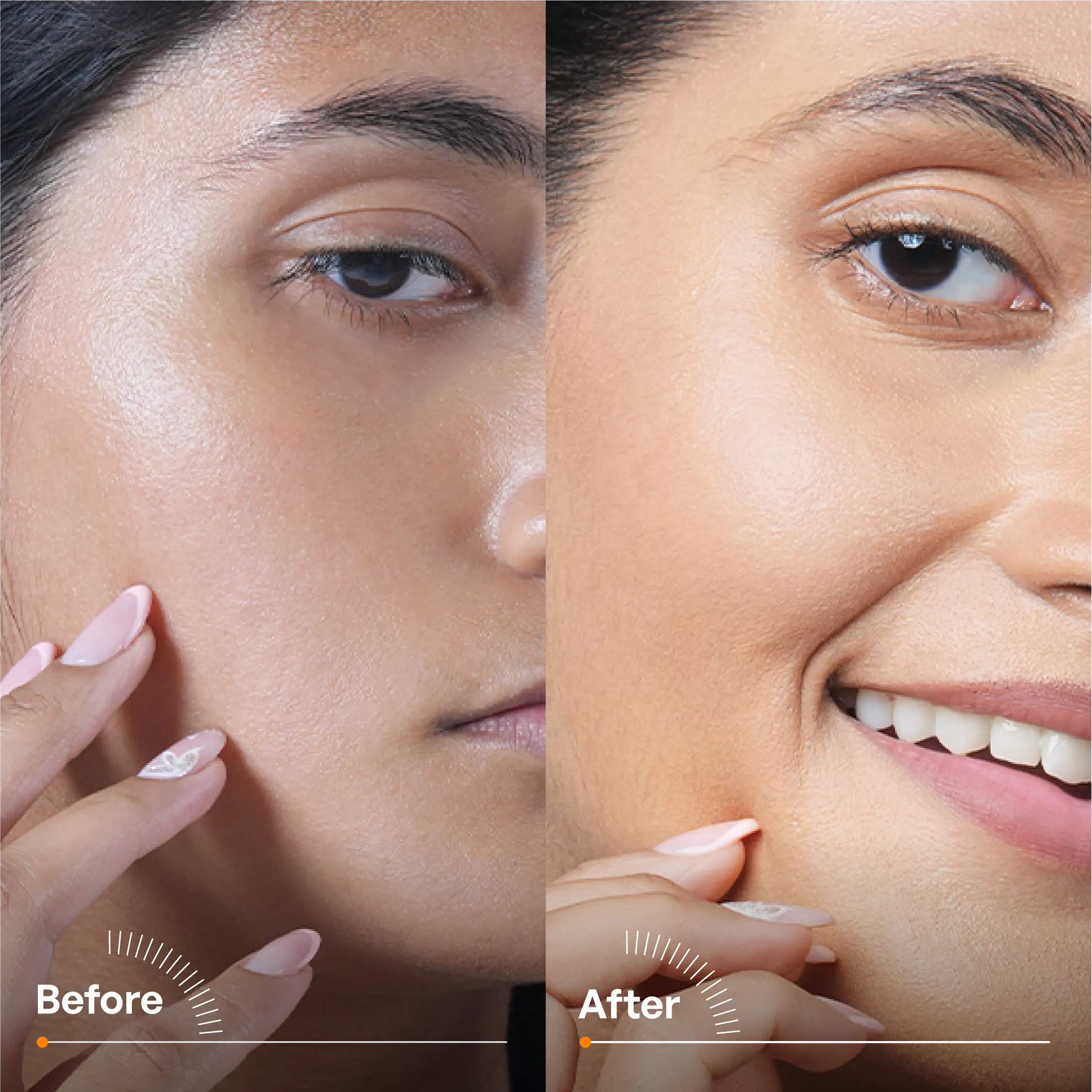 Tan Removal Combo - Image 4